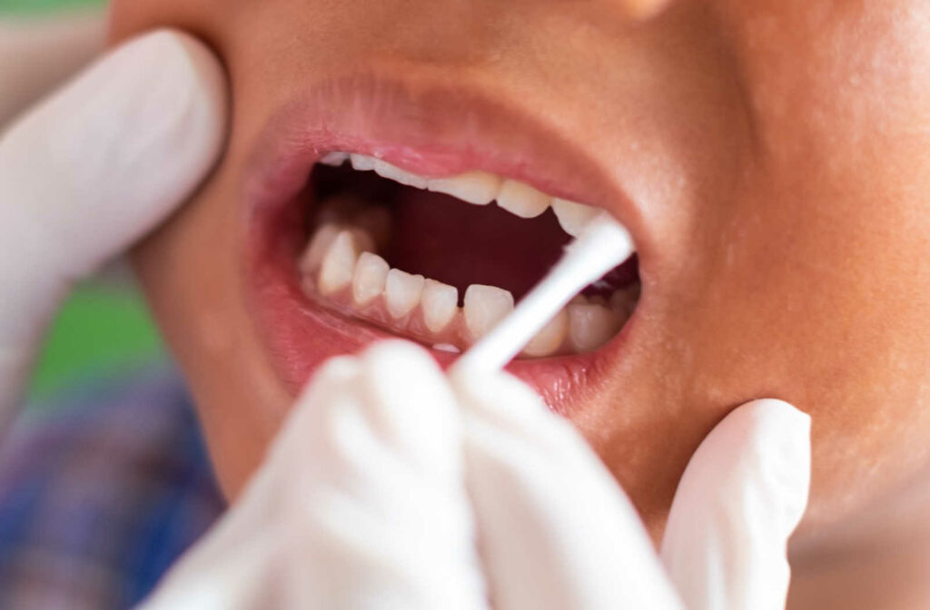 Close-up hands of a dentist applying fluoride on a little boy's teeth.